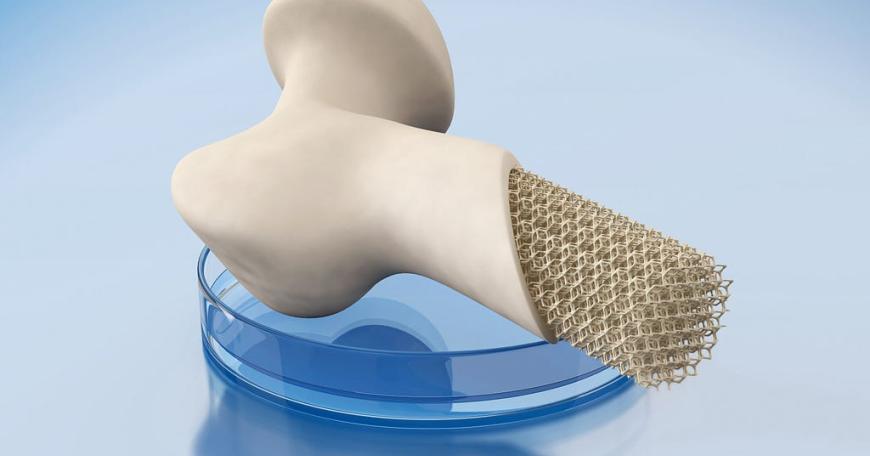 Additive manufacturing is disrupting healthcare — are you ready?