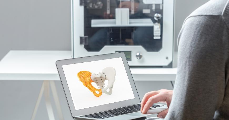 Person using generative design application to design a prosthetic hip joint. 